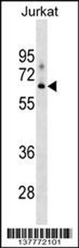 XYLB Antibody (N-term)