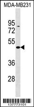 ZBTB25 Antibody (C-term)