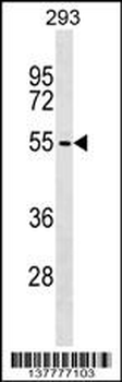 ZBTB6 Antibody (C-term)