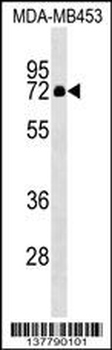 ZNF57 Antibody (N-term)