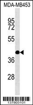 SHF Antibody (C-term)