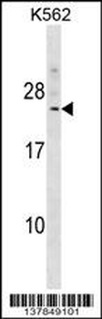 DCAKD Antibody (N-term)