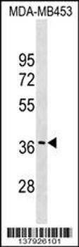 GJC3 Antibody (C-term)