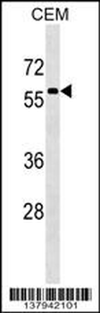 MSL3 Antibody (N-term)
