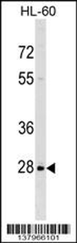 PPIL6 Antibody (N-term)