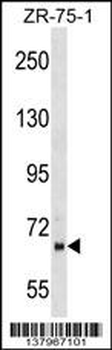 PPWD1 Antibody (Center)