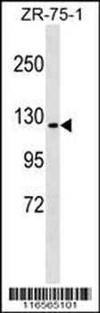 ERN1 Antibody (C-term)