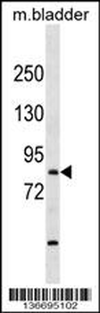 TBR1 Antibody (N-term)