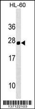 Mouse Hoxc5 Antibody (C-term)
