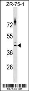 NKX2-1 Antibody (Center)