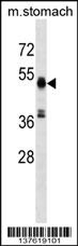 RMND5A Antibody (C-term)