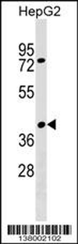 SNX32 Antibody (N-term)