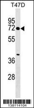 ZNF563 Antibody (N-term)