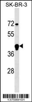 FBXL12 Antibody (C-term)