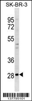 ZNF688 Antibody (N-term)