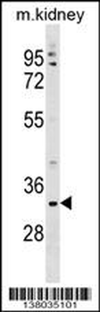 TMEM178 Antibody (Center)