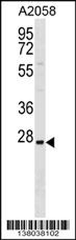 TRIM74 Antibody (C-term)