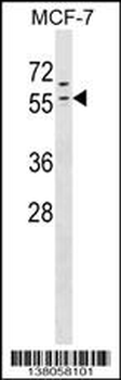 ZNF383 Antibody (N-term)