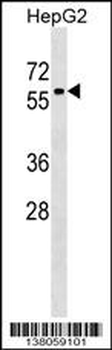 ZNF419 Antibody (Center)