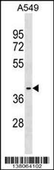 ZNF514 Antibody (N-term)