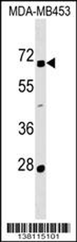 ZNF565 Antibody (N-term)
