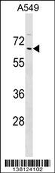ZNF675 Antibody (N-term)