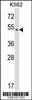 ACCN5 Antibody (C-term)