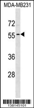 ADAT1 Antibody (N-term)