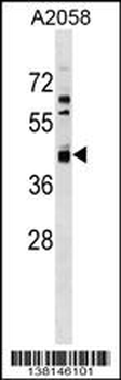AMDHD2 Antibody (Center)