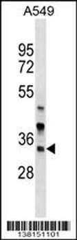 ARMC1 Antibody (C-term)