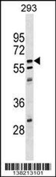 CPNE5 Antibody (C-term)