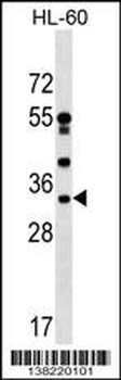 DNAJC17 Antibody (C-term)