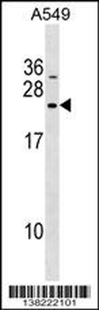 DNAJC5B Antibody (Center)