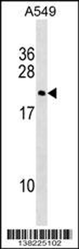 DUX3 Antibody (N-term)