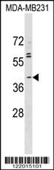 ABO Antibody (N-term)