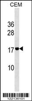 ADM2 Antibody (N-term)