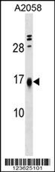 LBH Antibody (Center)