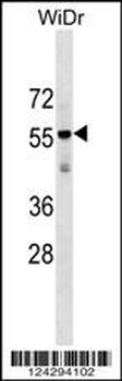 AGPAT9 Antibody (Center)