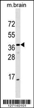 ELMOD1 Antibody (Center)