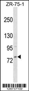 MICALCL Antibody (N-term)