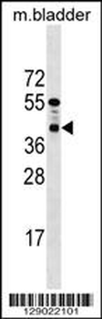 PPTC7 Antibody (C-term)