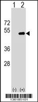 FNTA Antibody (N-term)