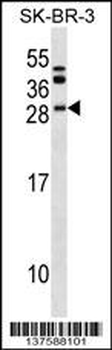 BCL7C Antibody (N-term)