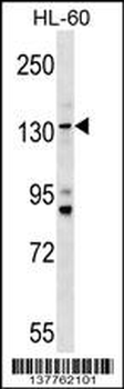 TMC5 Antibody (Center)