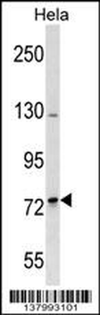 SH3RF2 Antibody (Center)