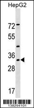 LZTFL1 Antibody (N-term)