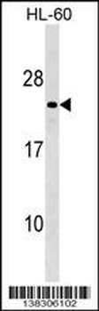 MS4A8B Antibody (N-term)