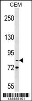 ITGB2 Antibody (N-term)