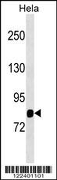 MASP1 Antibody (Center)