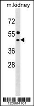 ALG11 Antibody (C-term)